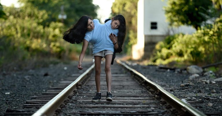 What 17 Year Old Conjoined Twins Carmen and Lupita Andrade Look Like Today