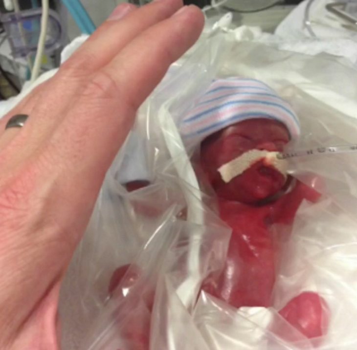 Mom Brings Everyone To Tears As She Holds 12-Ounce Baby Girl For The First Time