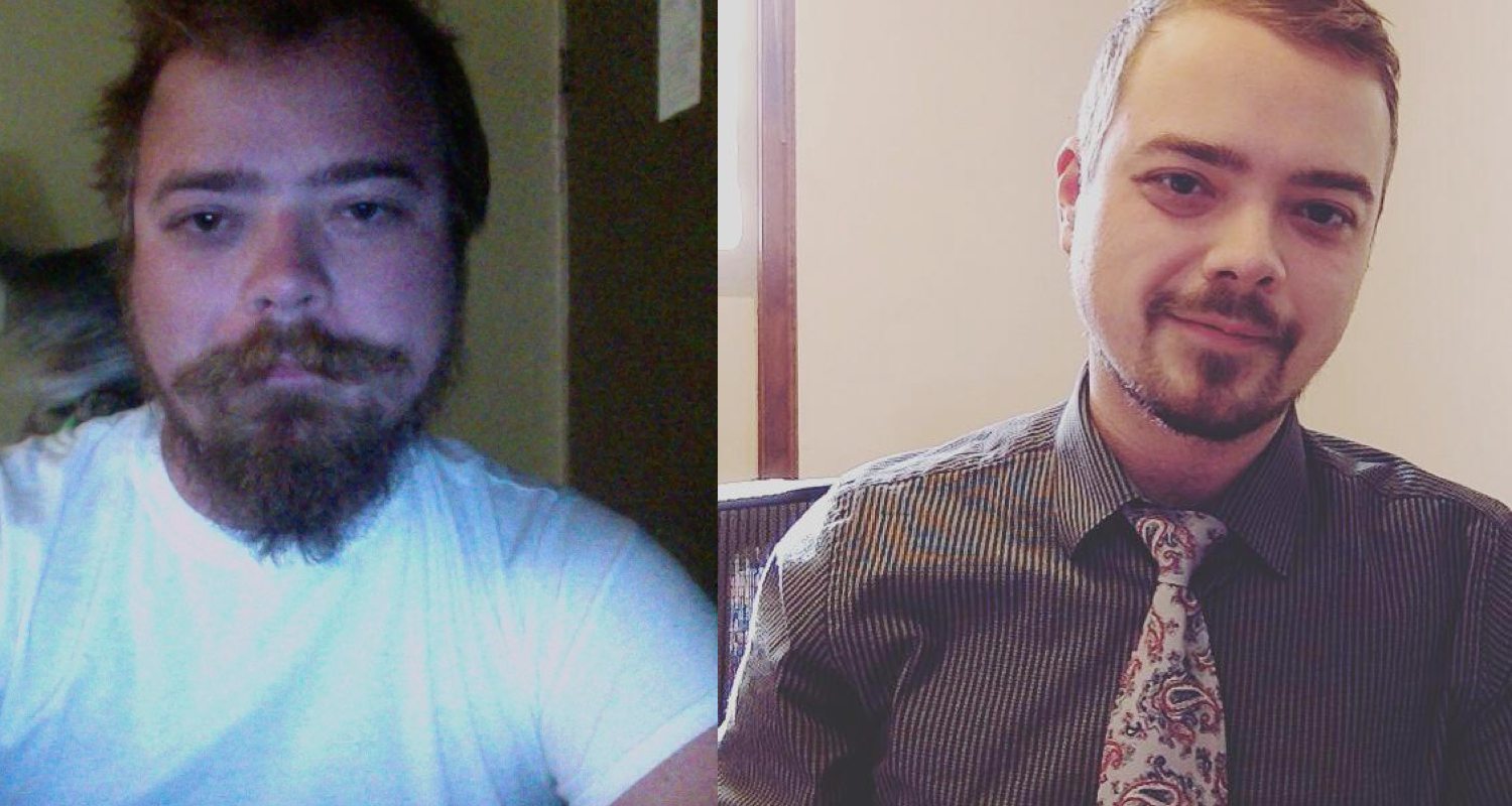 6 Before And After Photos That Show They Power Of Sobriety