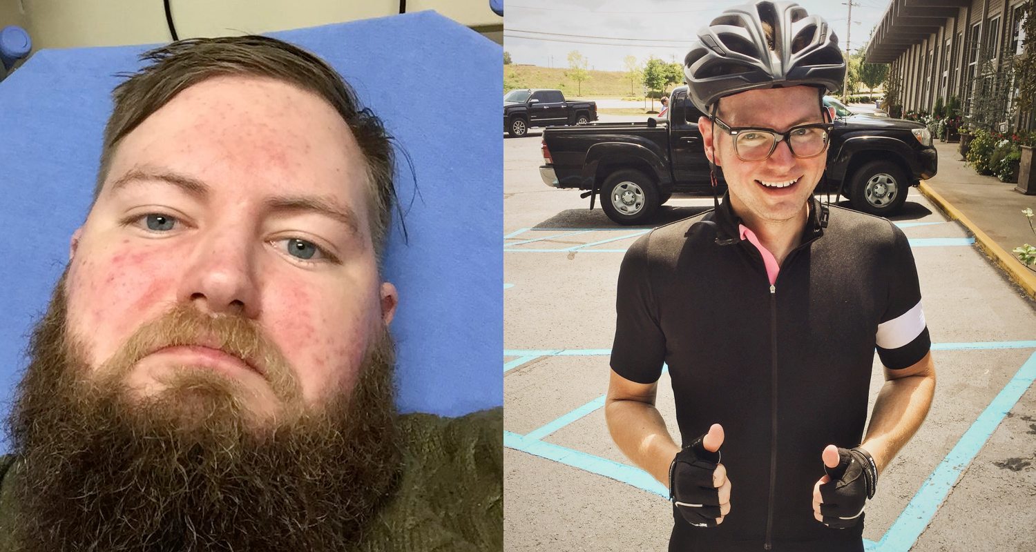 6 Before And After Photos That Show They Power Of Sobriety
