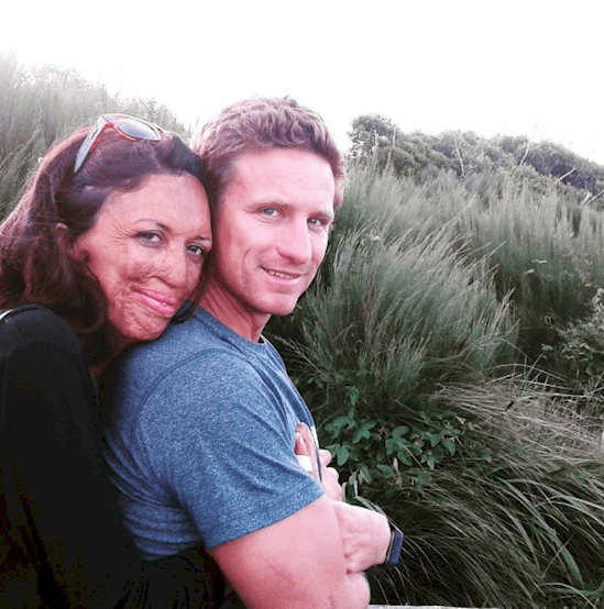 Man Gives Perfect Response When Asked If He’ll Stay With Wife After Fire Destroys Her Skin
