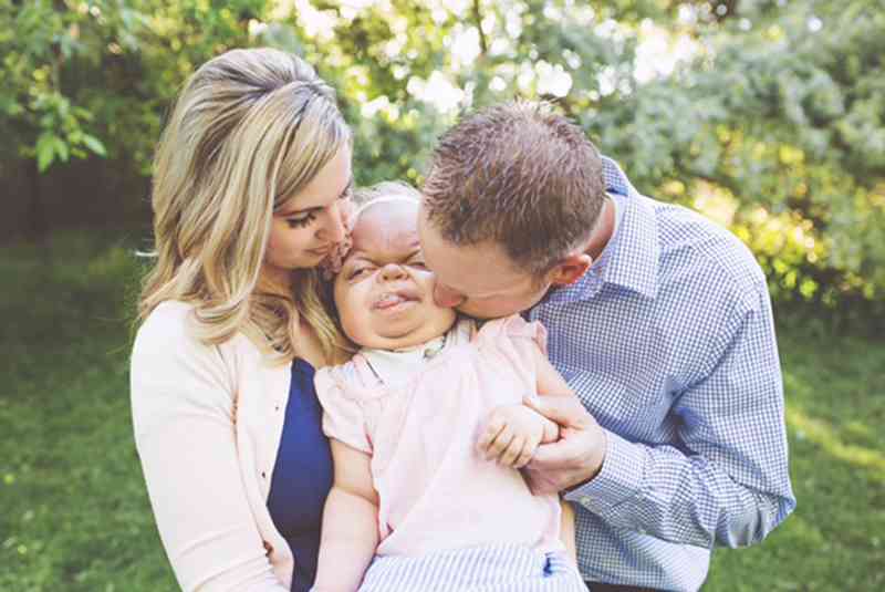 She Was Given Less Than A Year To Live When She Was Born, Now 4-Years Old She Defies the Odds