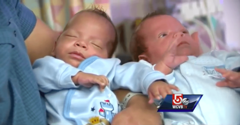 Premature Baby Is Born 24 Weeks Into Pregnancy, 3 Weeks Later Mom Gives Birth To His Twin!