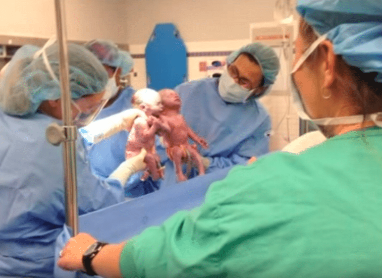 Mother Of ‘Miracle Sisters’ Born Holding Hands Explains How The Twins Helped Each Other Survive Their 1st Year Of Life