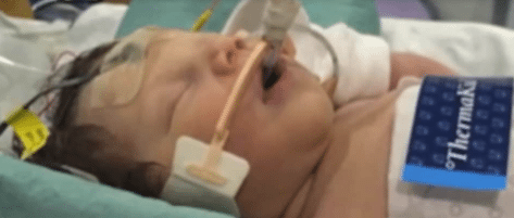 Premature Baby Is Silent & Dying, 8 Minutes Later Parents Hear The Most Incredible Sound Of Their Lives
