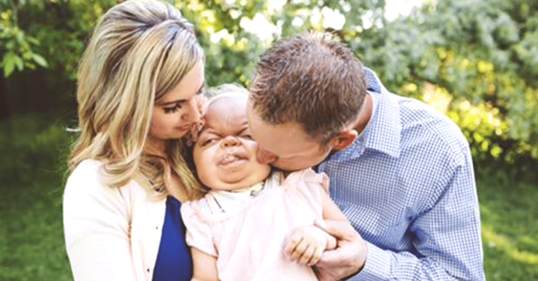 She Was Given Less Than A Year To Live When She Was Born, Now 4-Years Old She Defies the Odds