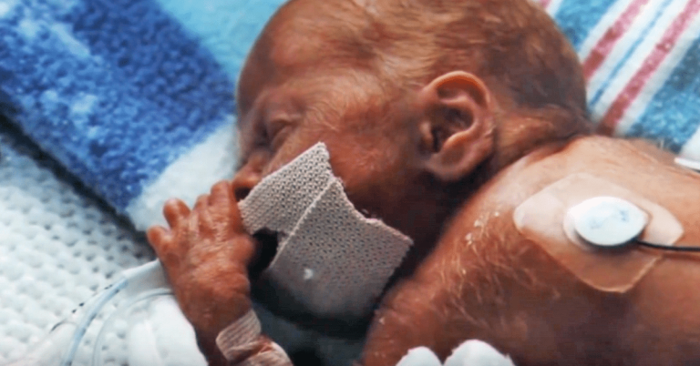 He Was Born Blind, Weighing Less Than 2 Lbs. Wait Till You See What He’s Doing Now!