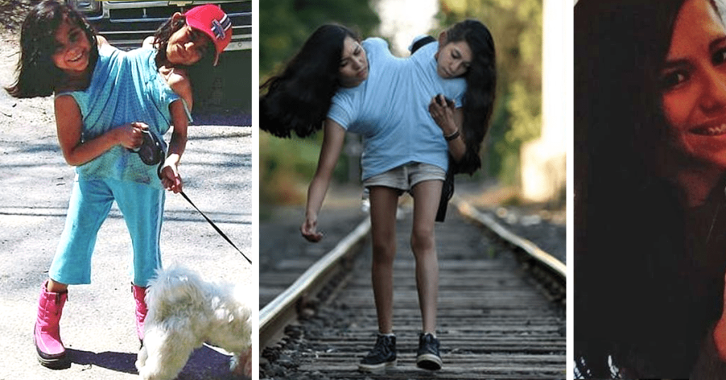 What Conjoined Twins Carmen and Lupita Andrade Look Like Now