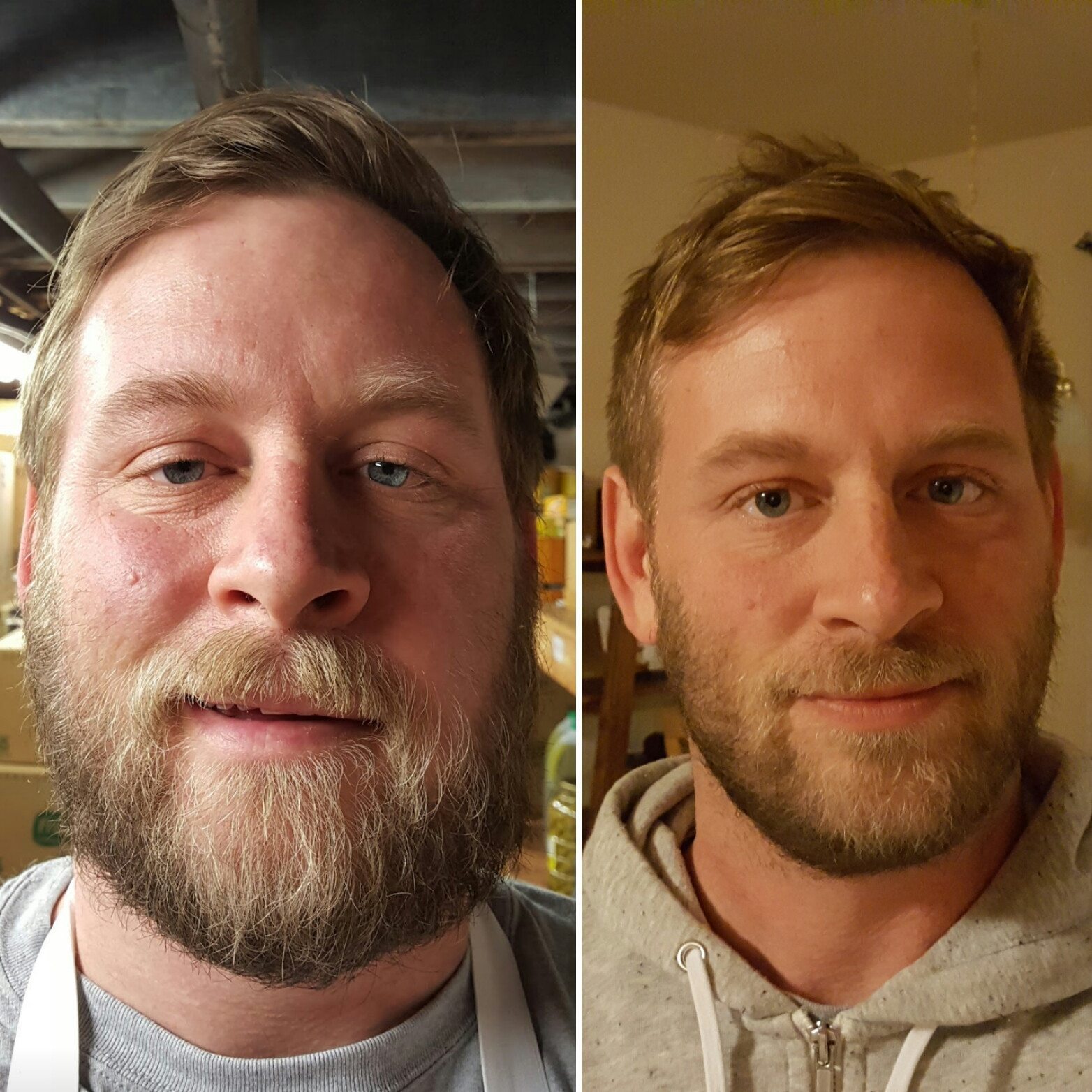 6 Before And After Photos That Show They Power Of Sobriety