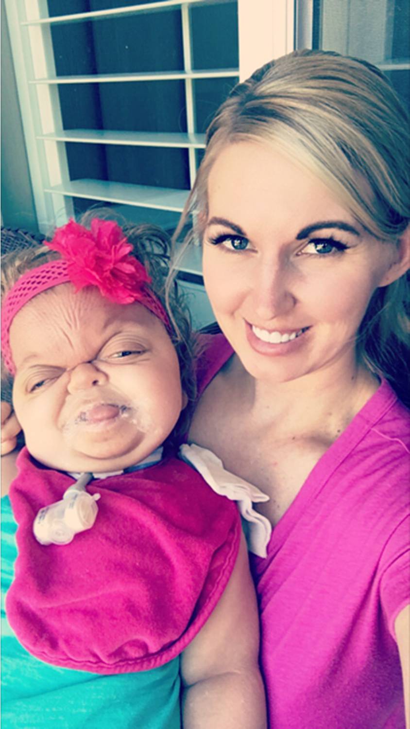 She Was Given Less Than A Year To Live When She Was Born, Now 4-Years Old She Defies the Odds