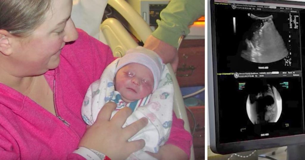 Huge Mass In Sick Newborn Miraculously Vanishes Moments Before Surgery