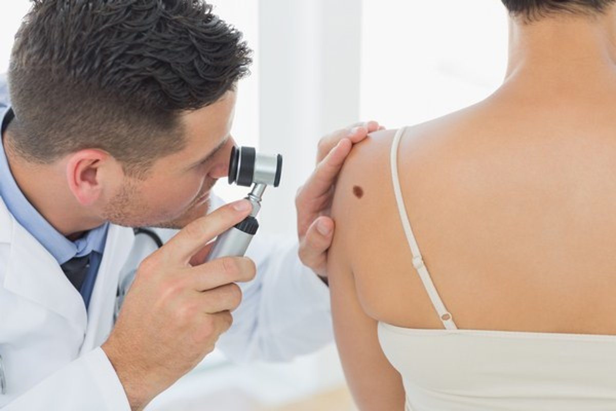 Not Worried About Skin Cancer? 4.3 million cases are reported in the US each year