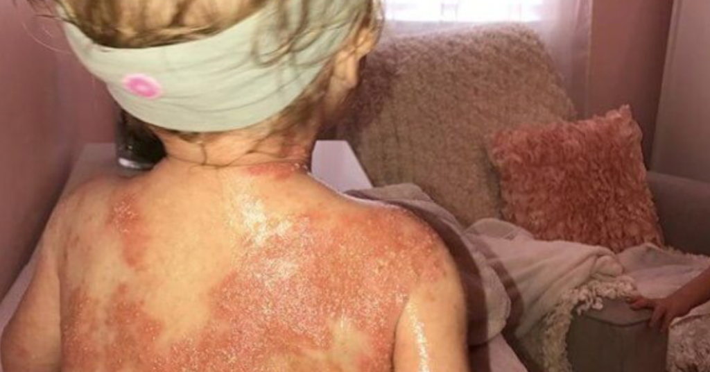 Strangers Are Afraid To Catch Baby’s Disease… So Fed-Up Mom Decides To Do This In Public