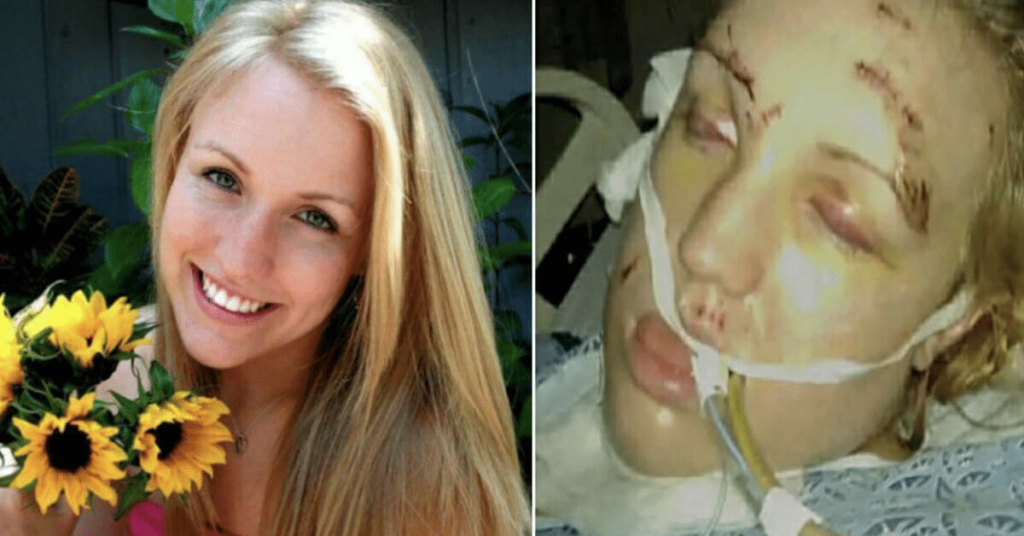 Jealous ex stabs girlfriend 32 times. 1 year later rescuer whispers 6 words that change everything