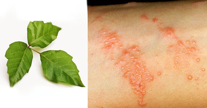 This Is A Way To Never, Ever Get Poison Ivy Again