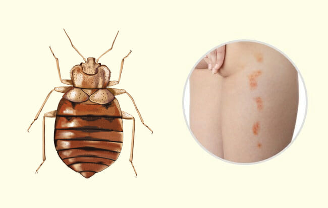 10 Common Insect Bites and Stings Everyone Should Learn to Recognize