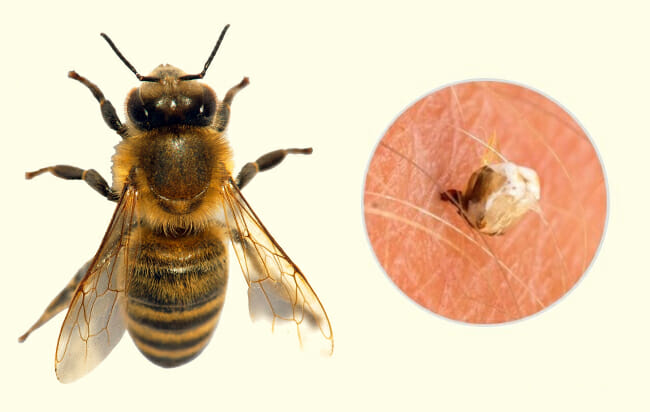 10 Common Insect Bites and Stings Everyone Should Learn to Recognize
