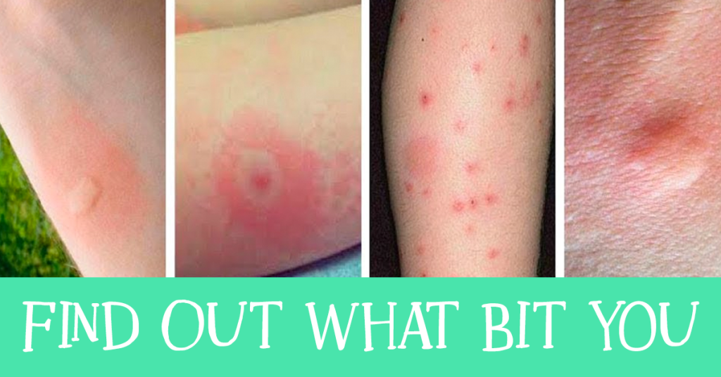 10 Common Insect Bites and Stings Everyone Should Learn to Recognize
