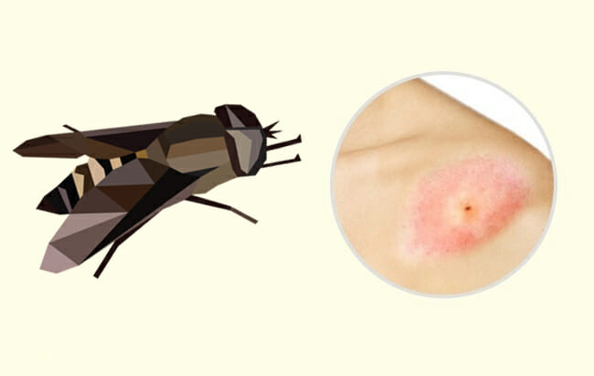 10 Common Insect Bites and Stings Everyone Should Learn to Recognize