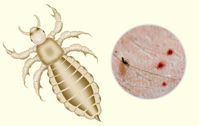 10 Common Insect Bites and Stings Everyone Should Learn to Recognize