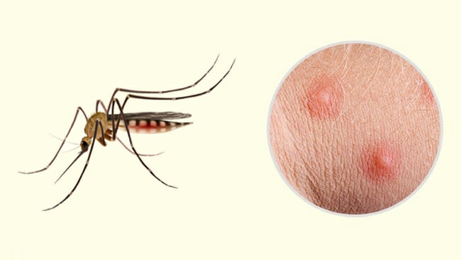 10 Common Insect Bites and Stings Everyone Should Learn to Recognize