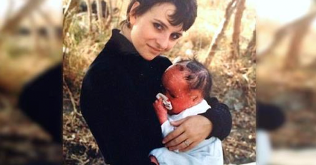 ‘Bright Red’ Baby Was Not Expected To Live Long But Here She Is 20 Years Later