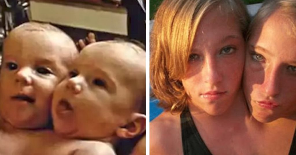 They Defied All Expectations – What They Are Doing Now Is Amazing