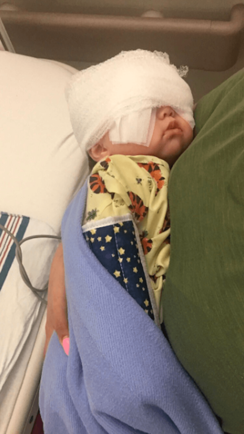 Toddler’s Big Eyes Resemble A Disney Princess, But They’re Due To A Rare Condition