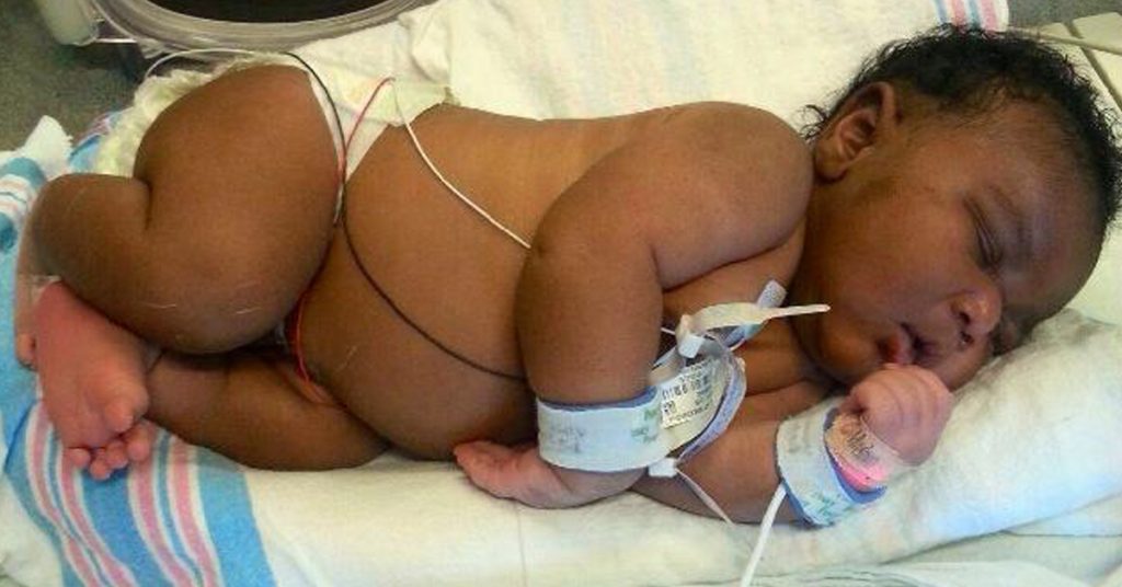 Woman Gives Birth to the Biggest Baby Ever