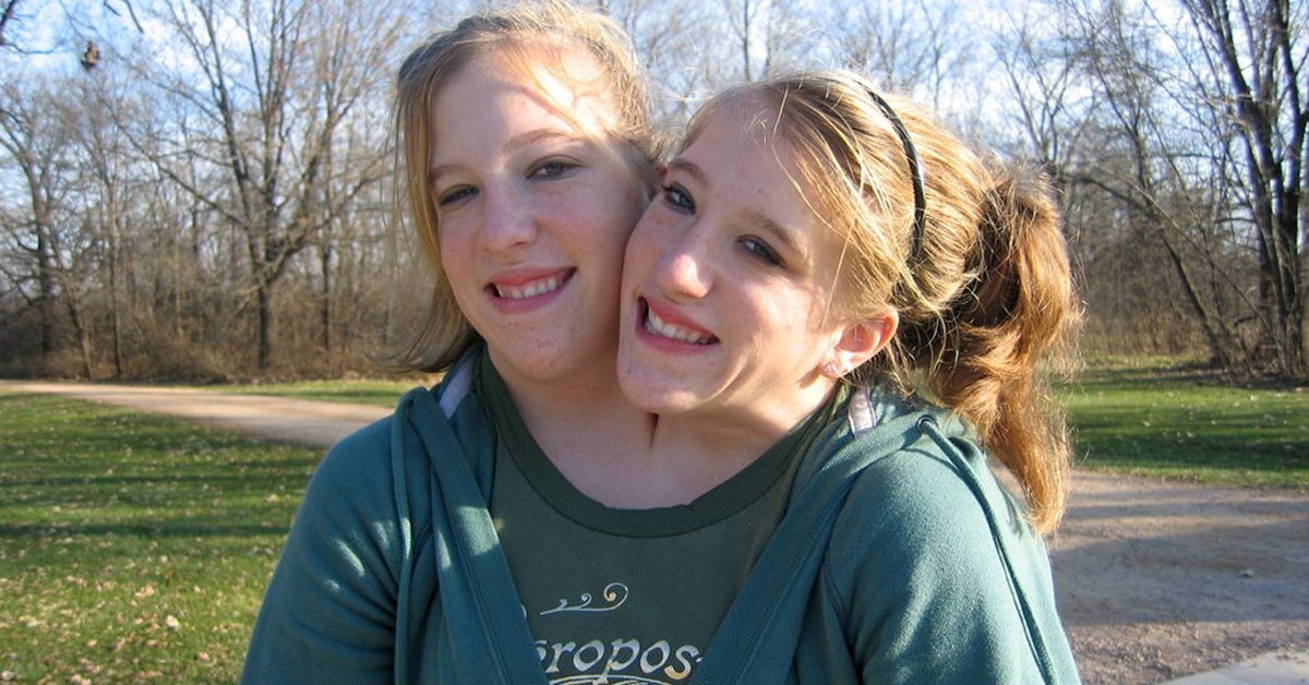 Conjoined Twins Abby and Brittany Hensel Live an Extremely Low-Profile Life Today