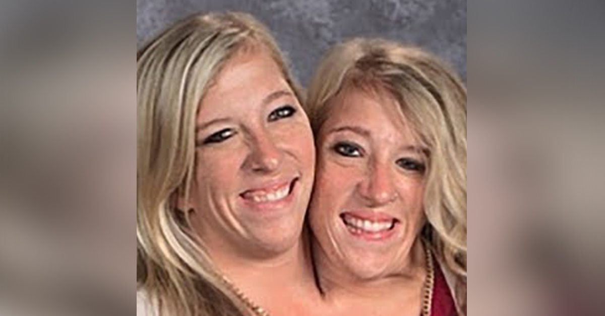 Conjoined Twins Abby and Brittany Hensel Live an Extremely Low-Profile Life Today