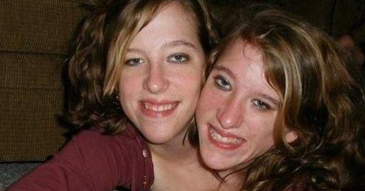What Conjoined Twins Abby And Brittany Hensel Look Like Today