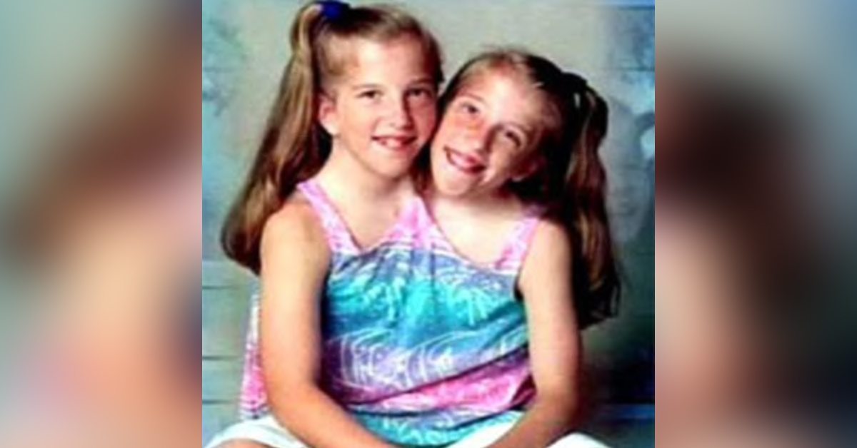 What Conjoined Twins Abby And Brittany Hensel Look Like Today