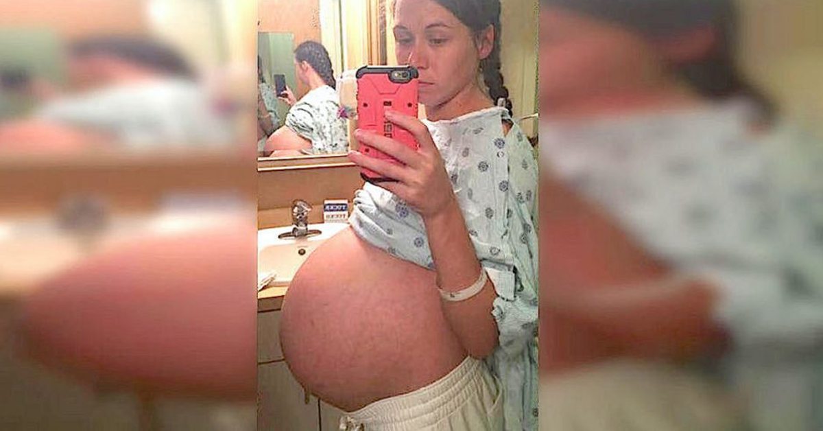 Mom gives birth to identical triplets – The chances of it happening can be as high as 1 in 200 million