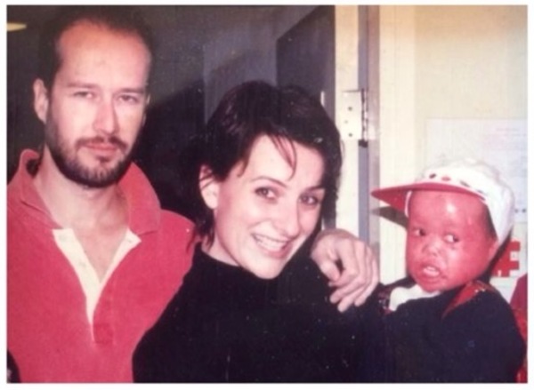 Baby Suffers From Rare Condition But Defies All Odds And Is Now 23-years-old