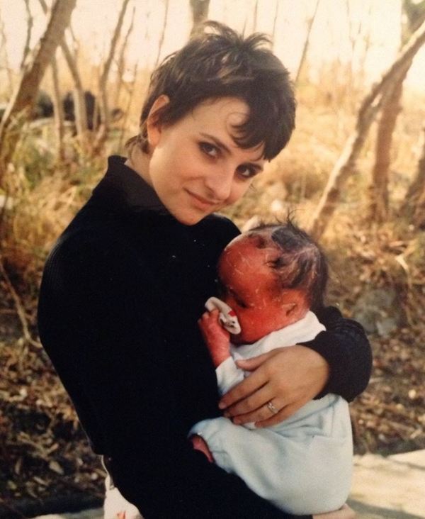 Baby Suffers From Rare Condition But Defies All Odds And Is Now 23-years-old