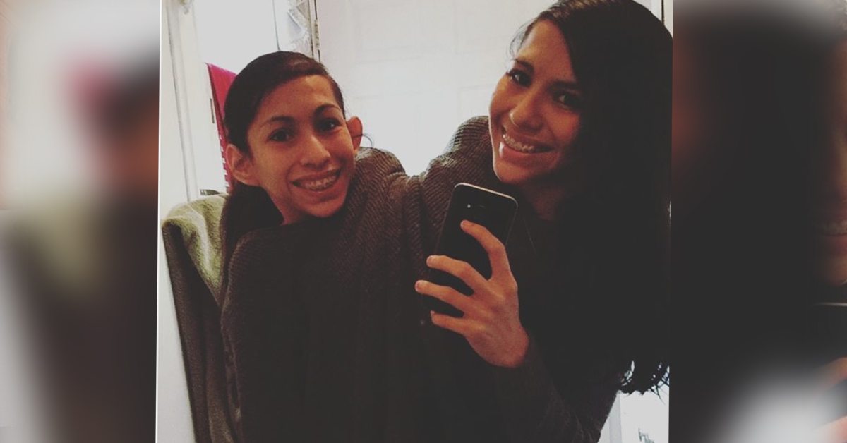 What Conjoined Twins Carmen and Lupita Andrade Look Like Today