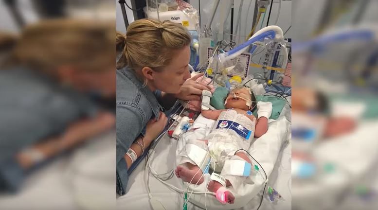 Baby Born Premature Declared Dead Then 8 Minutes Pass And Doctors Witness Miracle As Baby Is Revived