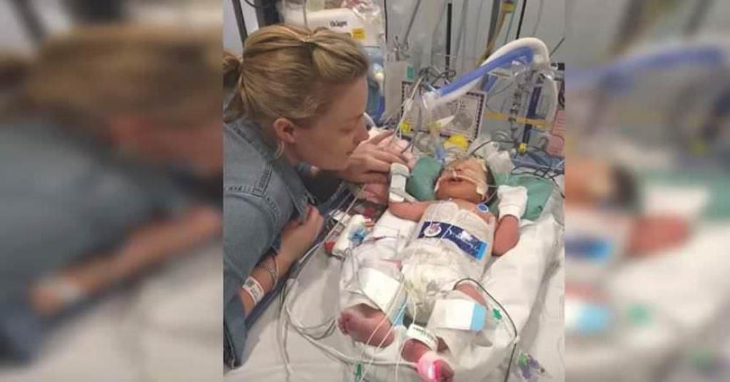 Baby Born Premature Declared Dead Then 8 Minutes Pass And Doctors Witness Miracle As Baby Is Revived