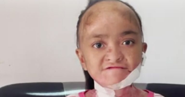 The Worst Disease You Have Never Seen of the Year